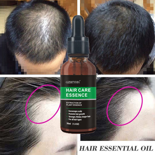 Hair Growth Oil Oem Hair Care Essential Oil