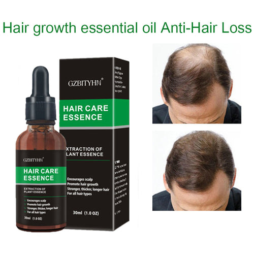 Hair Growth Oil Oem Hair Care Essential Oil